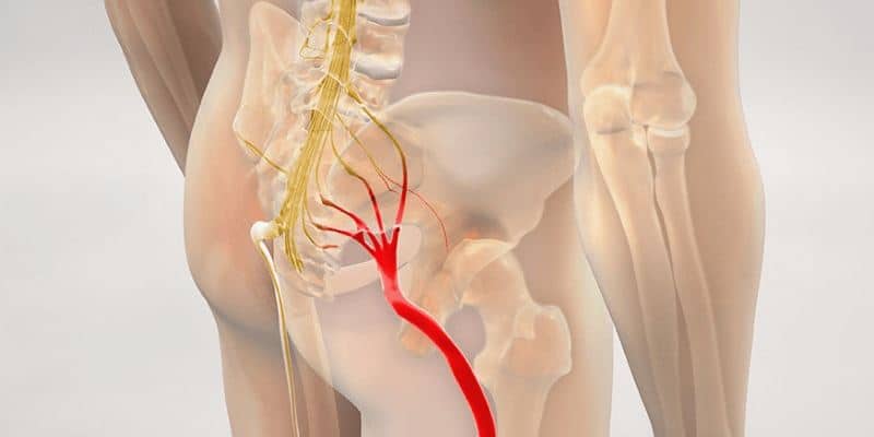 Physical Therapy Low Back Pain MovementX Sciatica Diagram