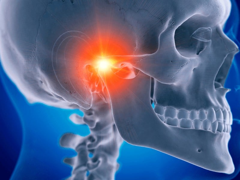 A 3D animated image of a skull and TMJ joint pain.