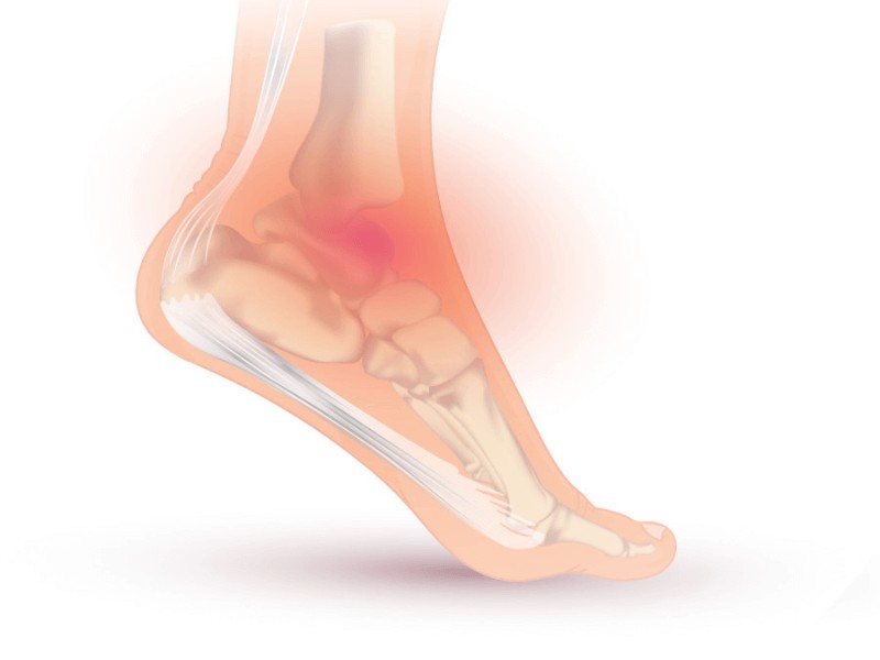 An anatomy image of an ankle and foot, showing the internal bones in the ankle and foot.