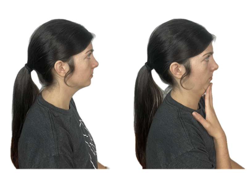 Dr. Lauren Scott demonstrating Chin Tucks.