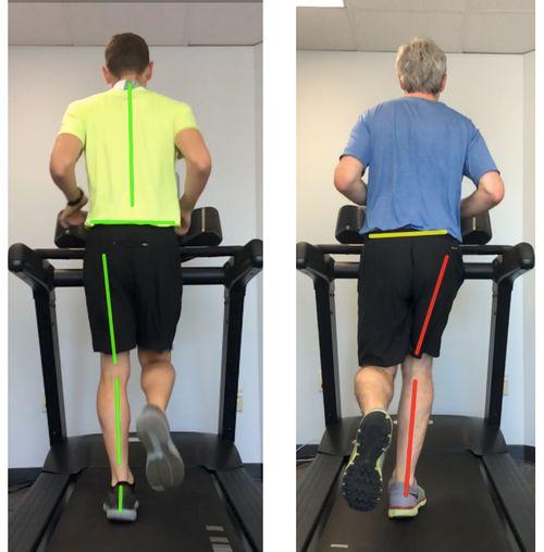 A side-by-side comparison of runners showing their hip alignment.