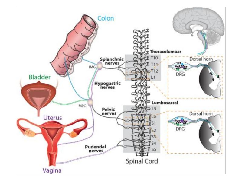 A diagram of all the contributory systems and mechanisms of endometriosis.